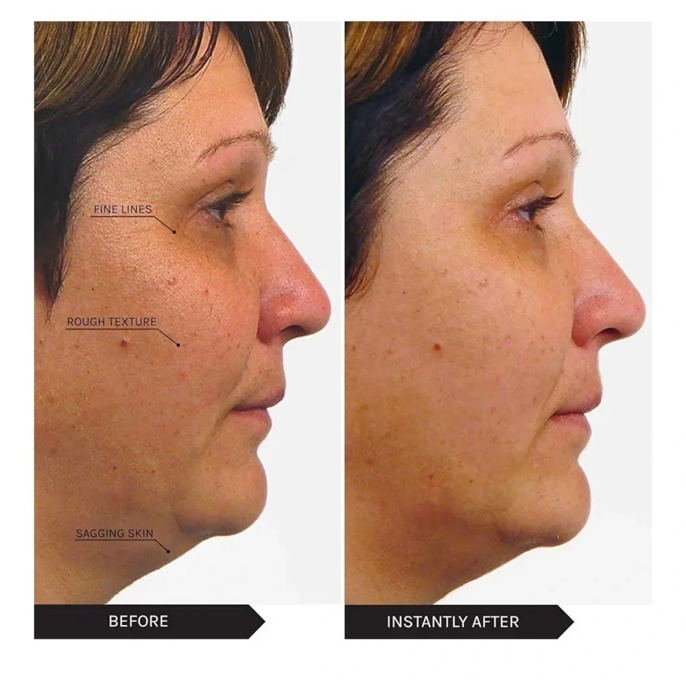 Power Lift Treatment Cream - White